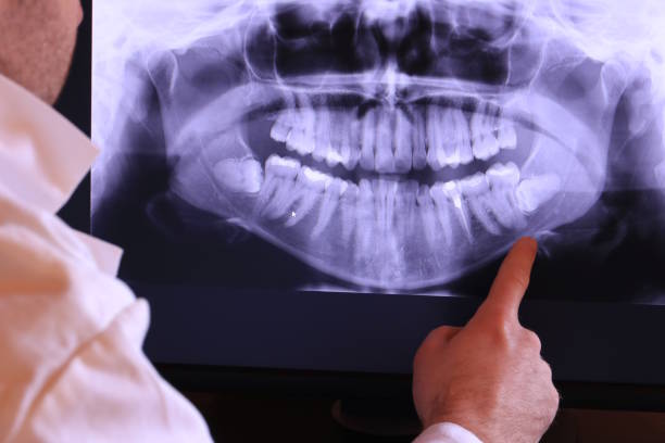Best Emergency Root Canal Treatment in Morrisonville, NY