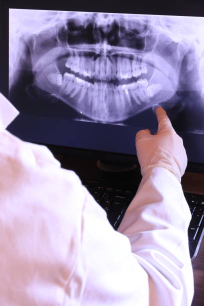 Best Same-Day Emergency Dentist in Morrisonville, NY