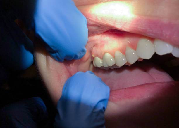 Best Emergency Dental Care for Trauma or Injury in Morrisonville, NY
